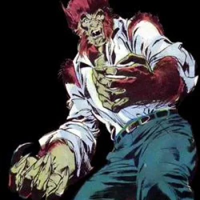 Anthony Lupus