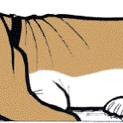 Fred Basset