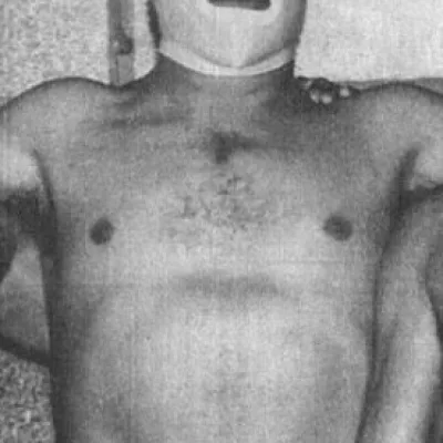 Médico Asesino
