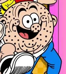 Spotty