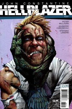 Phantom Pains, Part Five: Choke