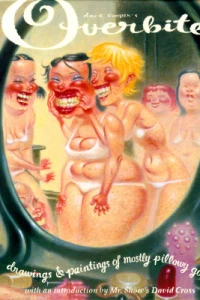 Overbite