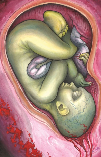 Baby Teeth (2015) - Series 