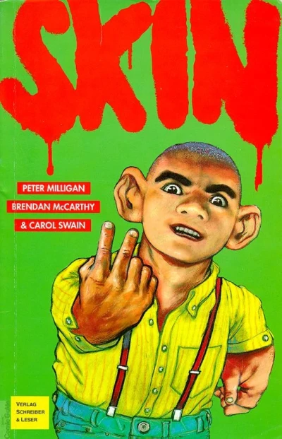 Skin (1993) - Series 