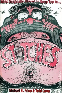 Stitches
