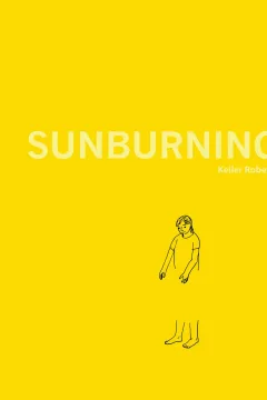 Sunburning